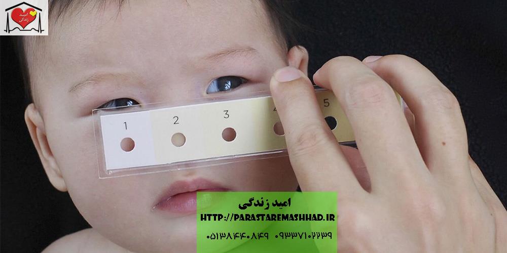 قیمت اجاره دستگاه زردی نوزاد در مشهد